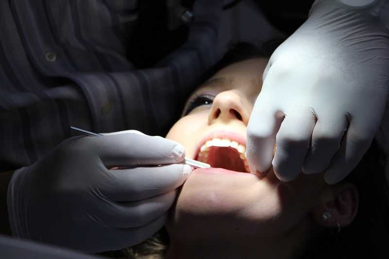 orthodontie vanaf 18 jaar